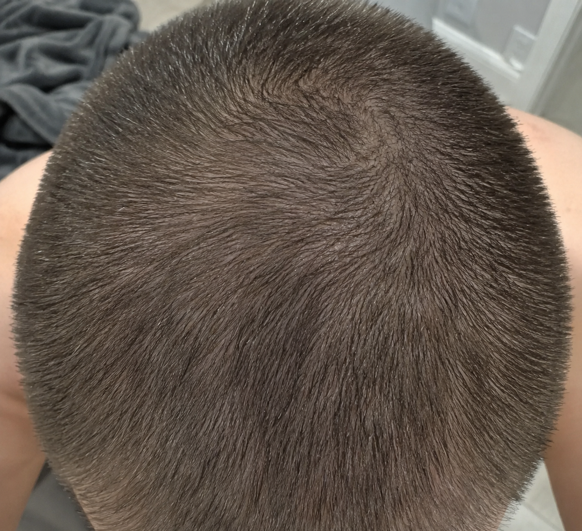 After